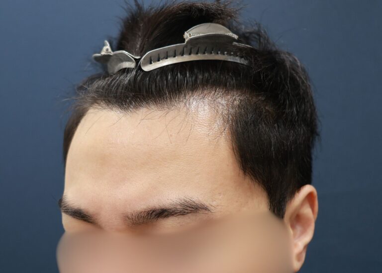 症例写真