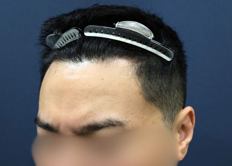 症例写真