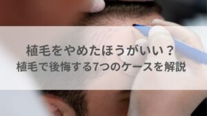 植毛をやめたほうがいい？植毛で後悔する7つのケースを解説