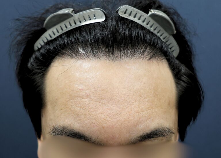 症例写真