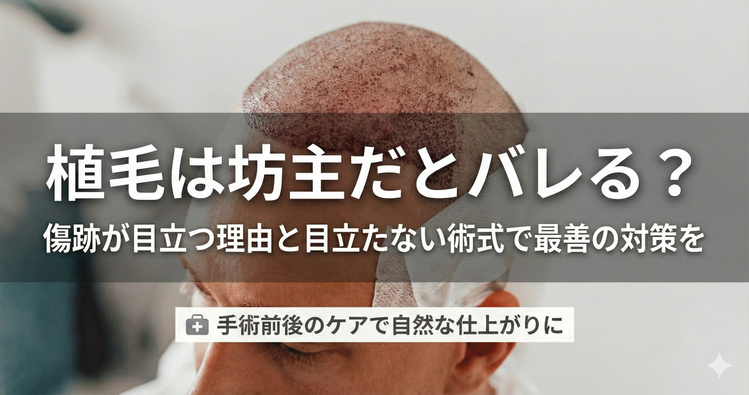 植毛は坊主だとバレる？傷跡が目立つ理由と目立たない術式で最善の対策を