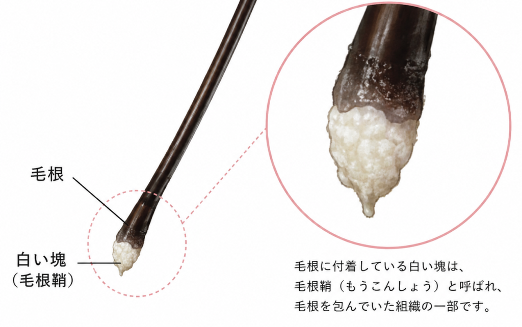 東京の植毛コラム「毛根鞘と皮脂の違い」