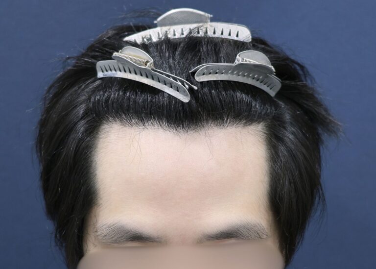 症例写真