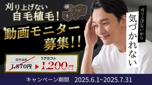 2025.6.1~7.31【自毛植毛】動画モニター募集のお知らせ