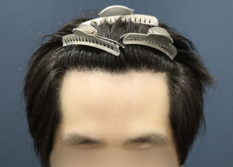 症例写真