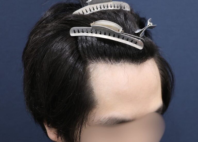 症例写真