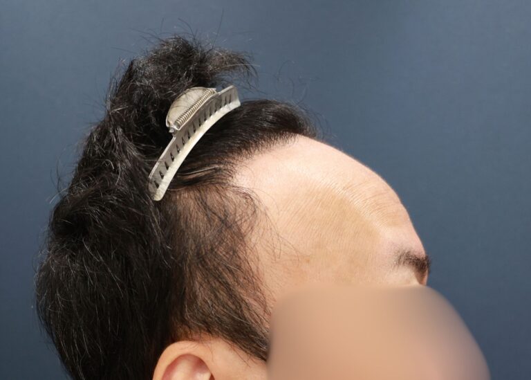 症例写真