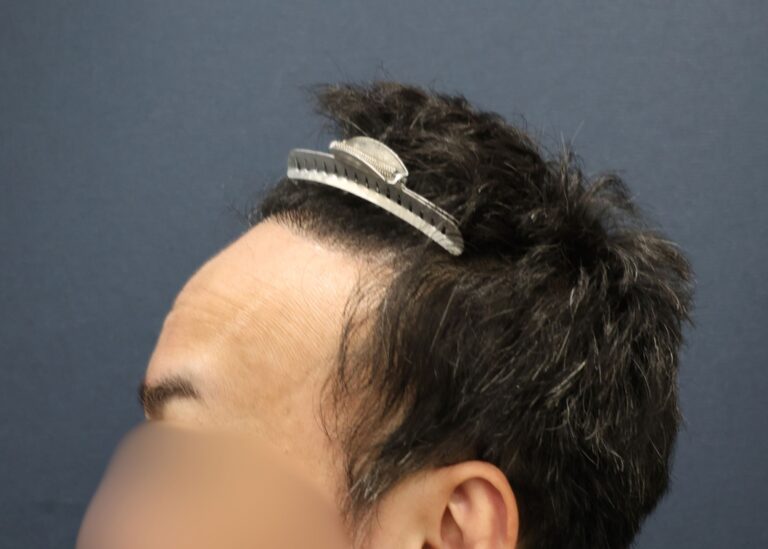 症例写真