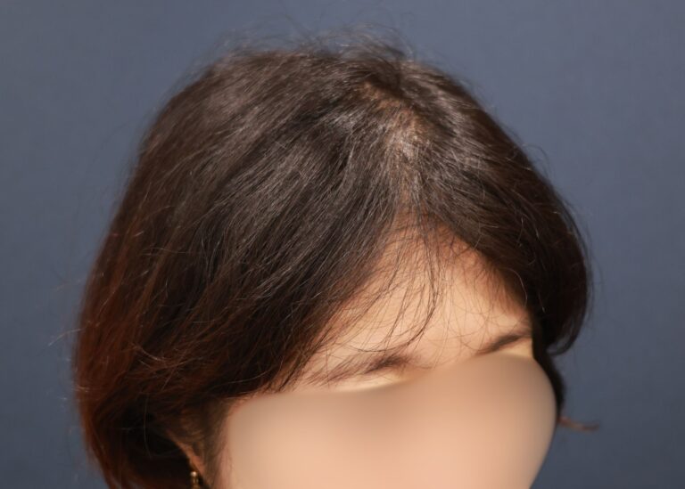 症例写真