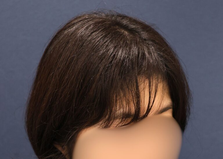 症例写真