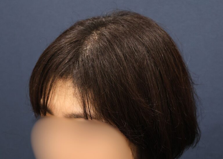症例写真
