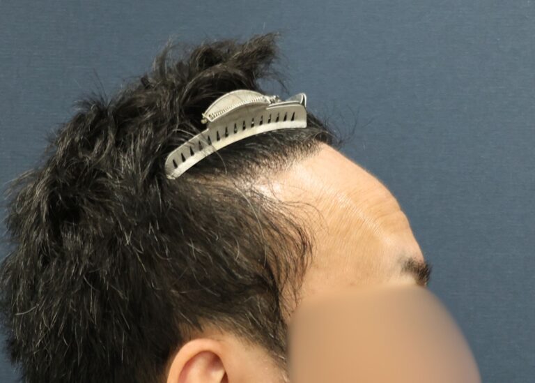 症例写真