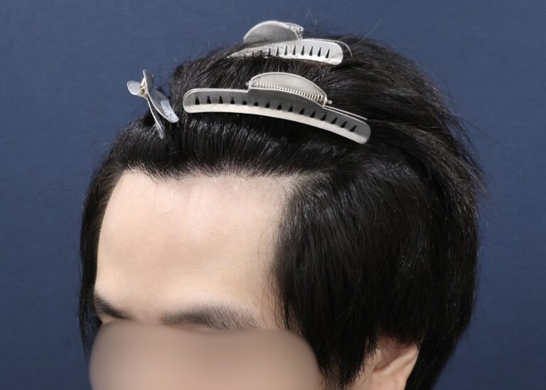 症例写真