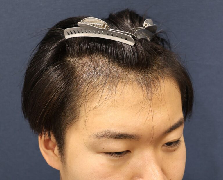 症例写真