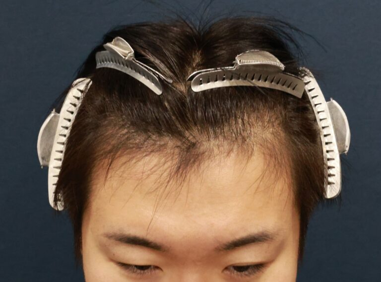 症例写真