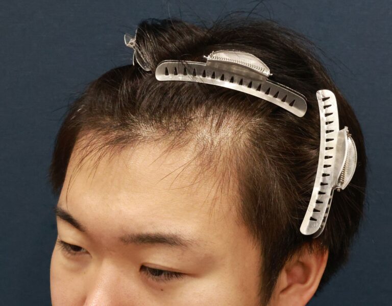 症例写真