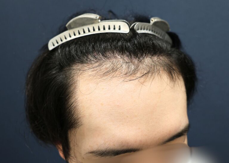 症例写真