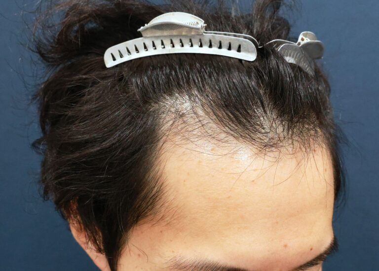 症例写真