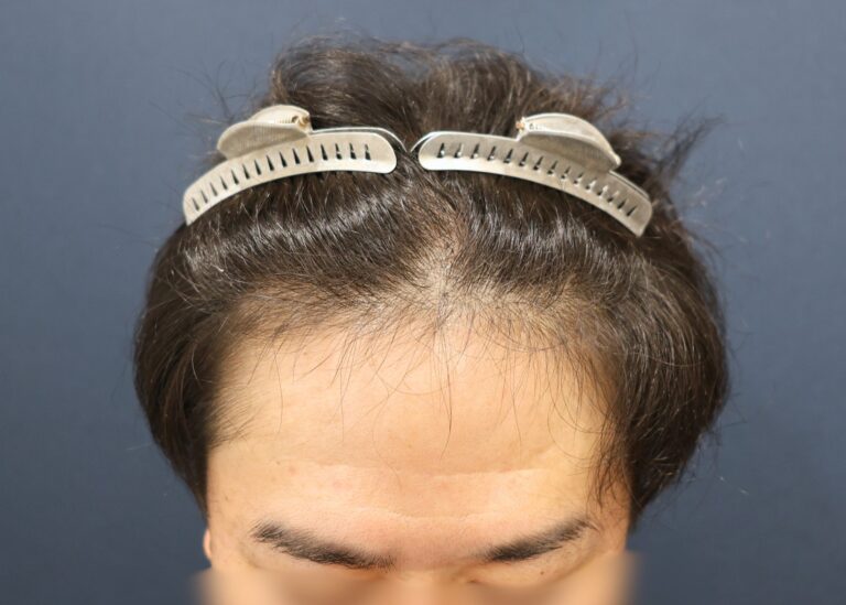 症例写真