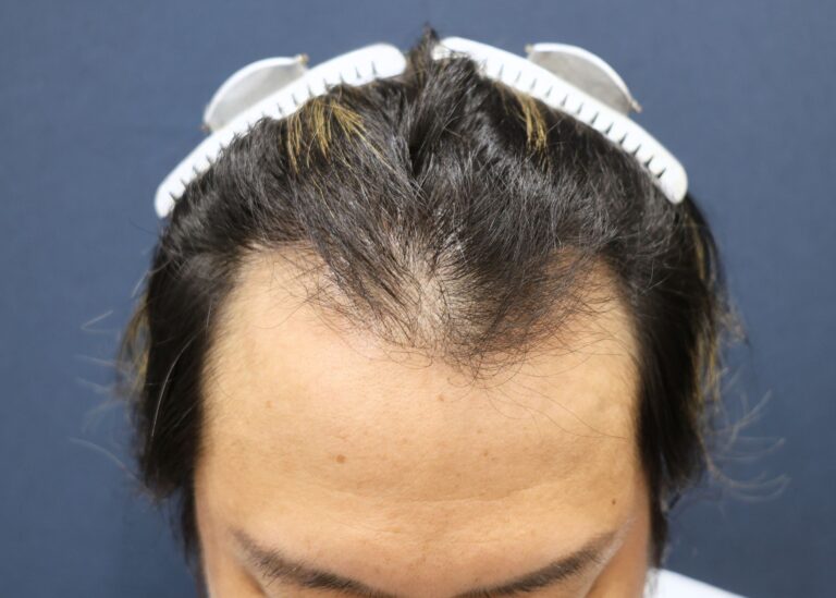 症例写真