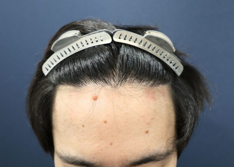 症例写真