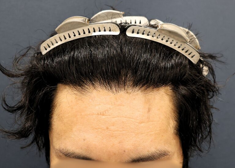 症例写真