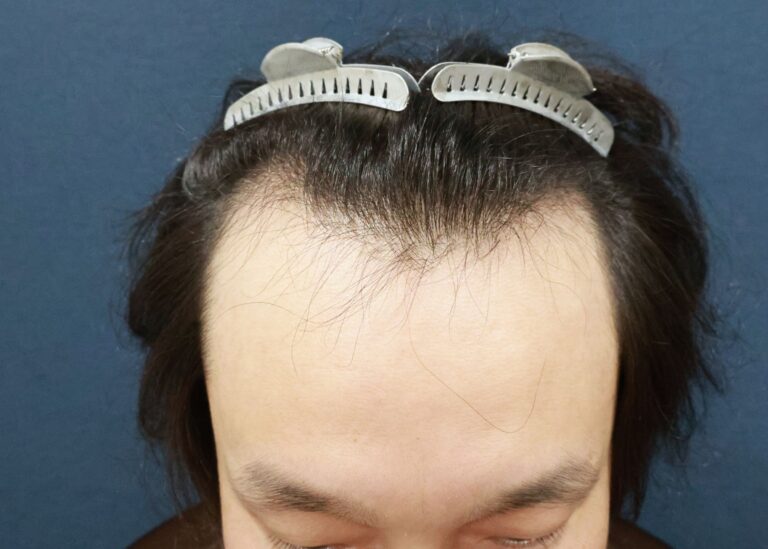 症例写真