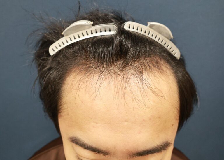 症例写真