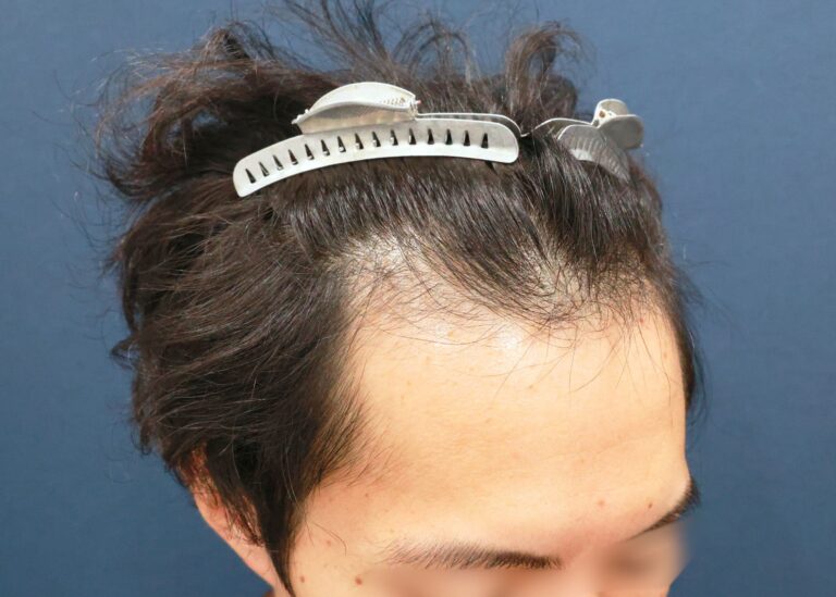 症例写真