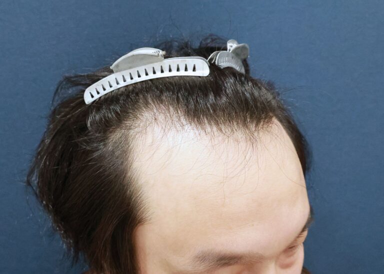 症例写真