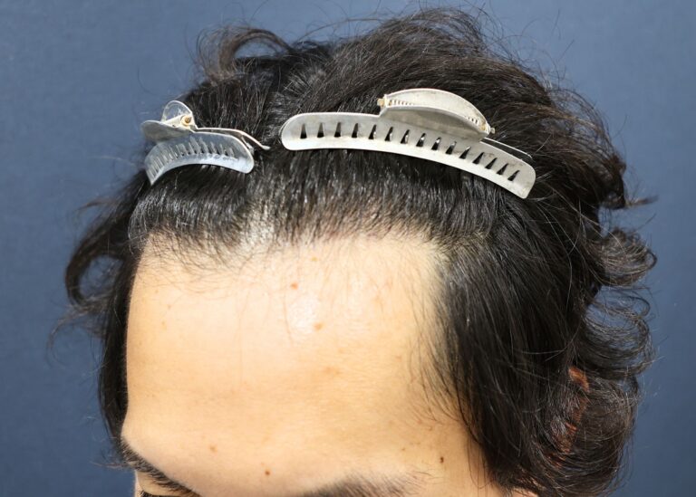 症例写真