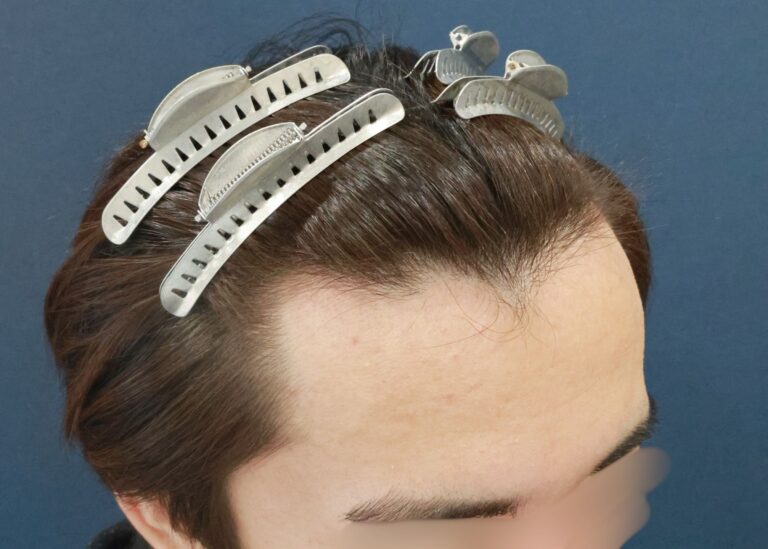 症例写真