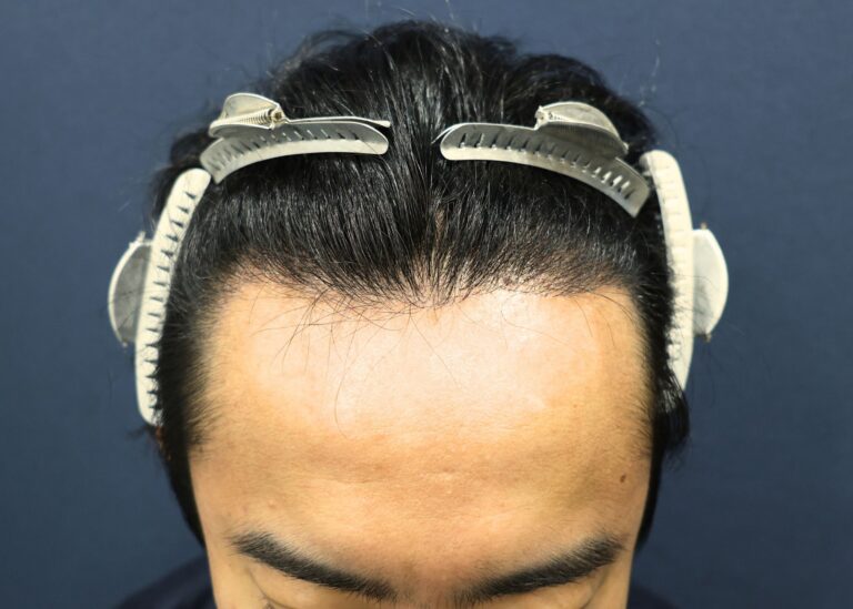 症例写真