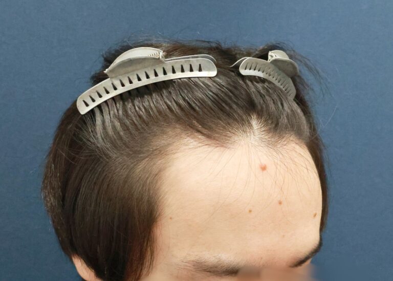 症例写真