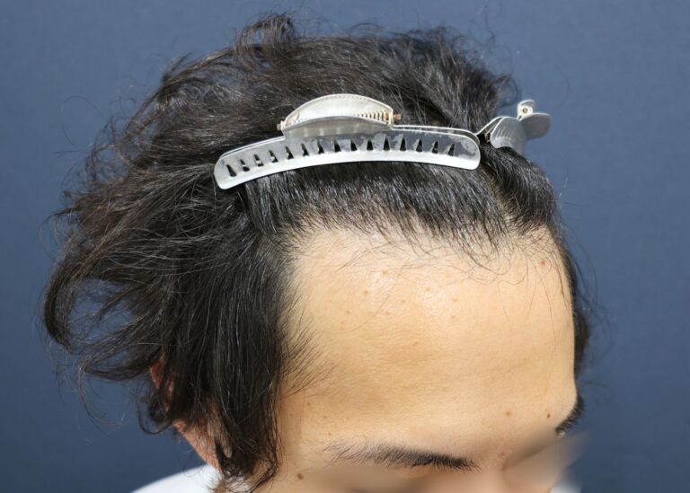 症例写真