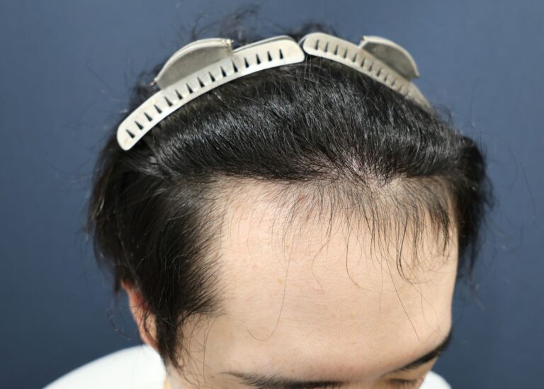 症例写真