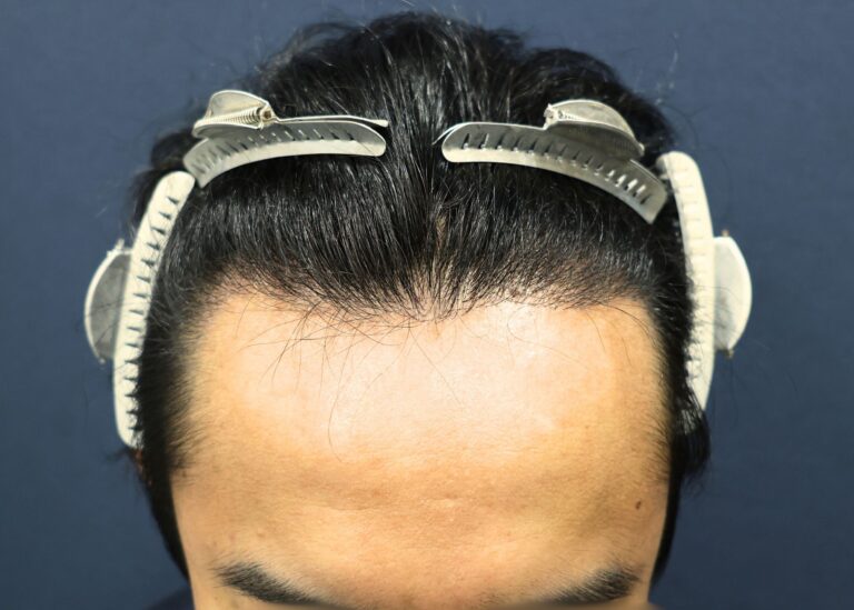 症例写真