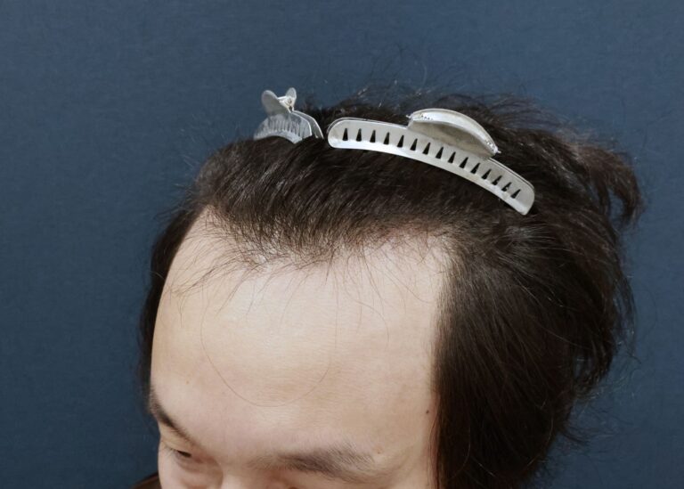 症例写真