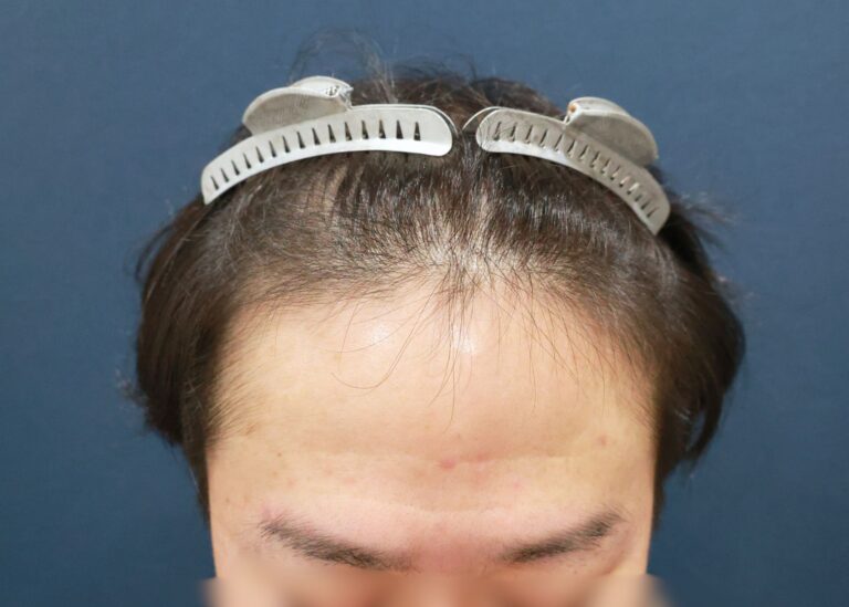 症例写真