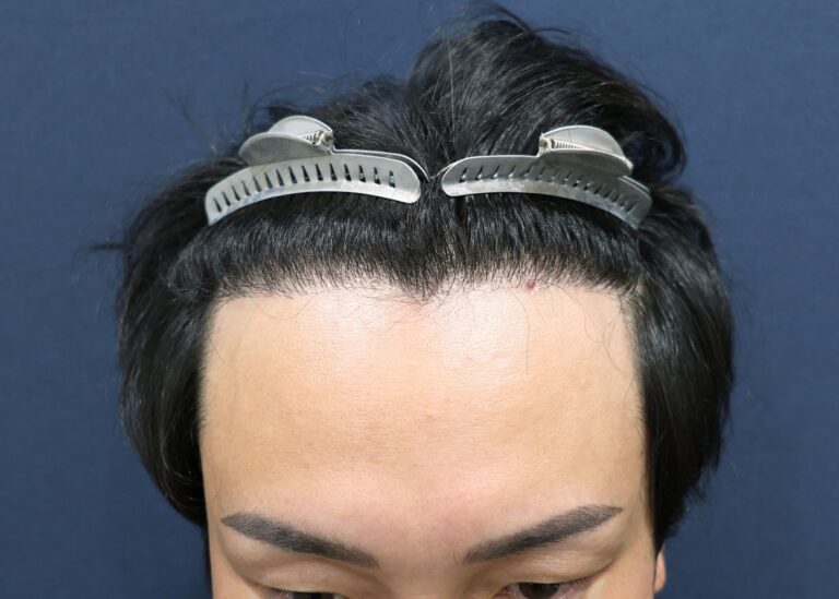 症例写真