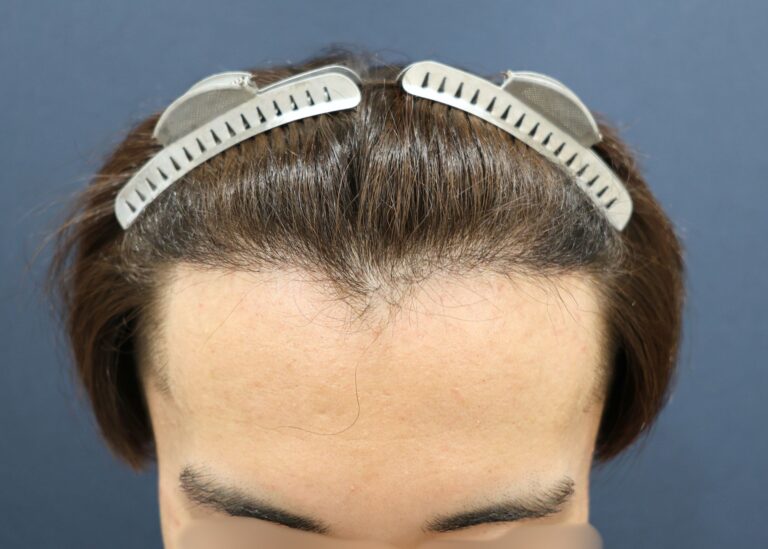 症例写真