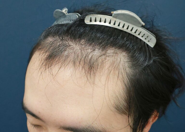症例写真