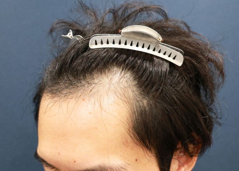 症例写真