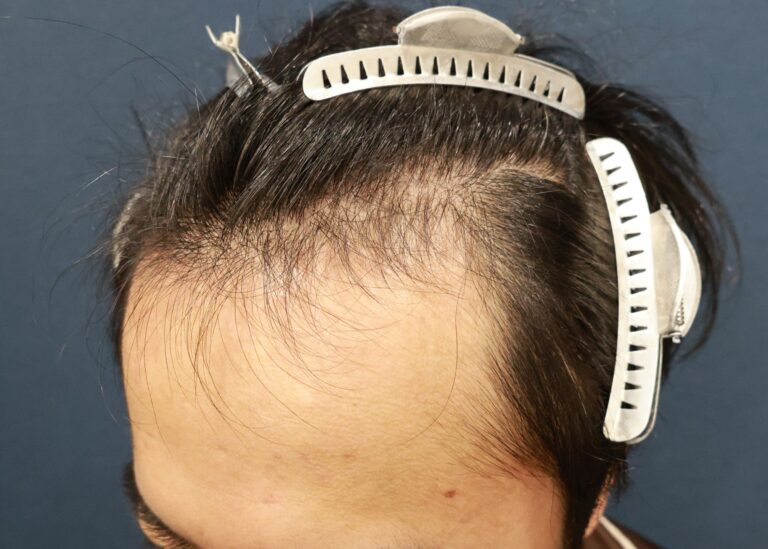 症例写真