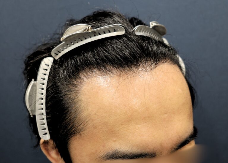 症例写真