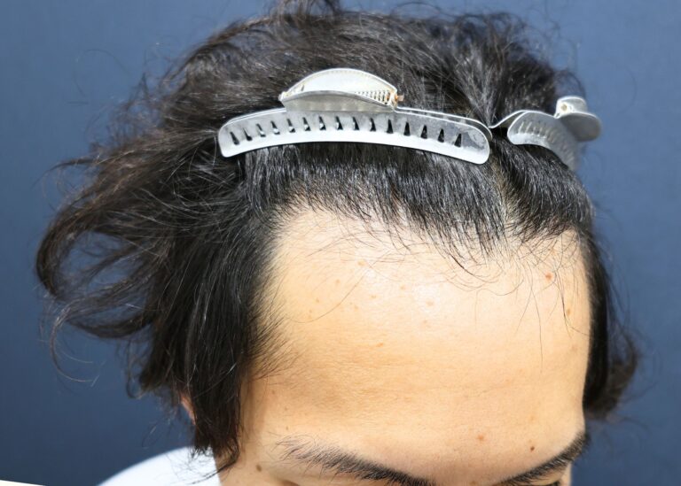 症例写真