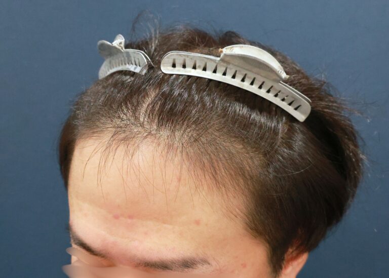 症例写真