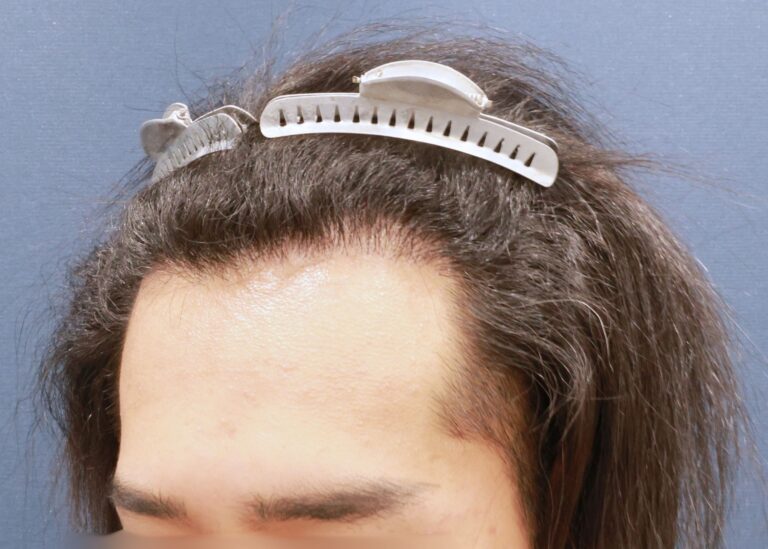 症例写真