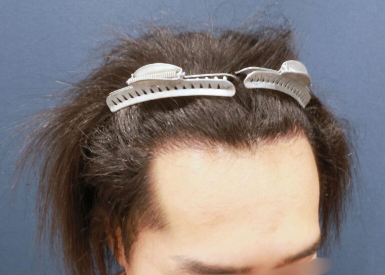 症例写真