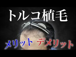 【危険】安すぎるトルコ植毛。術直後がエグすぎた…